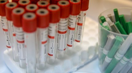 В Международном аэропорту Владивосток начал работу пункт тестирования на COVID-19