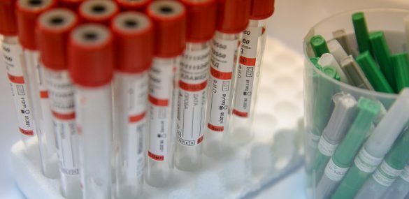 В Международном аэропорту Владивосток начал работу пункт тестирования на COVID-19